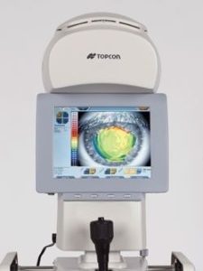 Hoornvliestopografie tijdens een Quick Scan