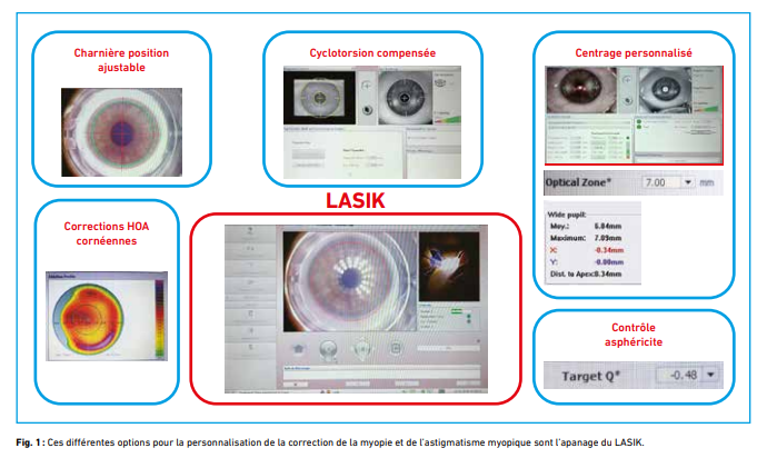 spécificité du lasik